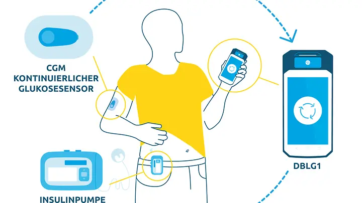 Diagram-DBLG1-ACCU-CHEK-INSIGHT-DE
