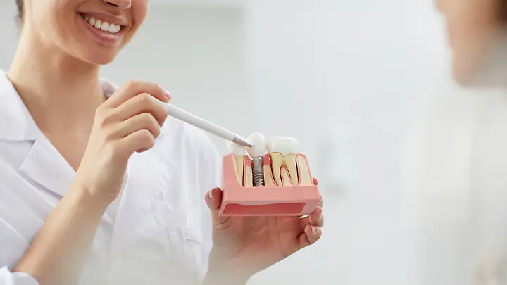 Eine Zahnärztin zeigt ein Implantat-Modell für eine mögliche Zahnzusatzversicherung mit Implantaten